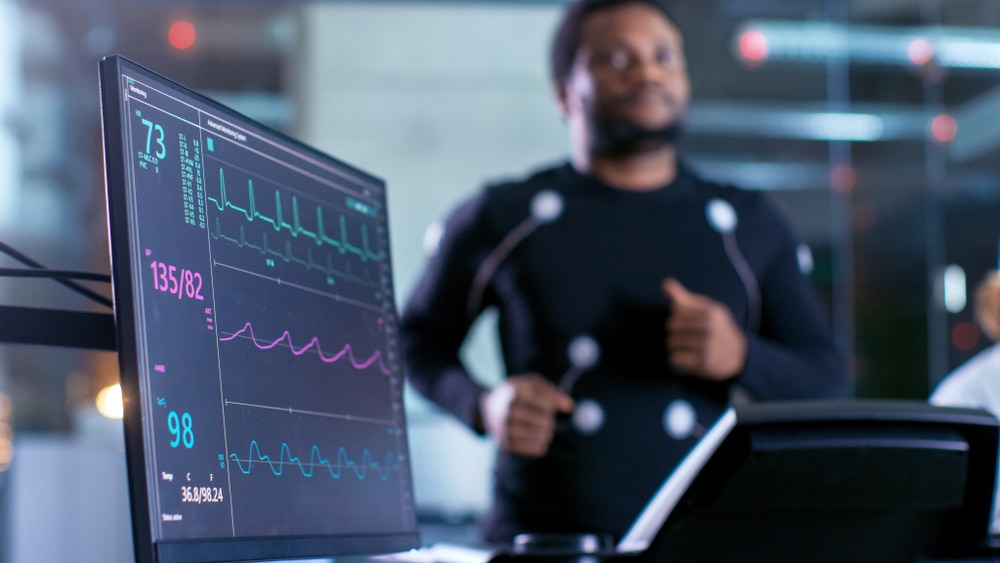 Man Running on a Treadmill — MedSurg Weight Loss in Brisbane, QLD